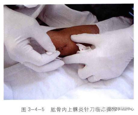 重磅推出针刀应用解剖与临床上下册李石良著中国中医药出版社