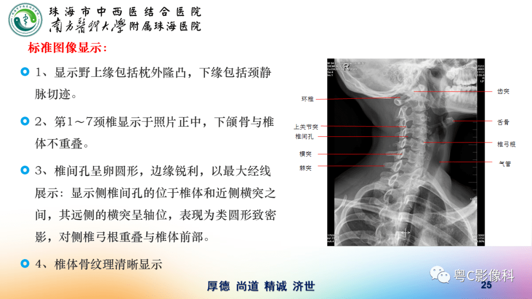 颈椎dr拍摄技术必须掌握的基本功