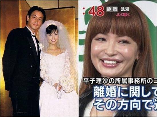 日本美魔女整容过度脸崩坏丈夫受不了离婚 吉田荣 平子理沙 村井克