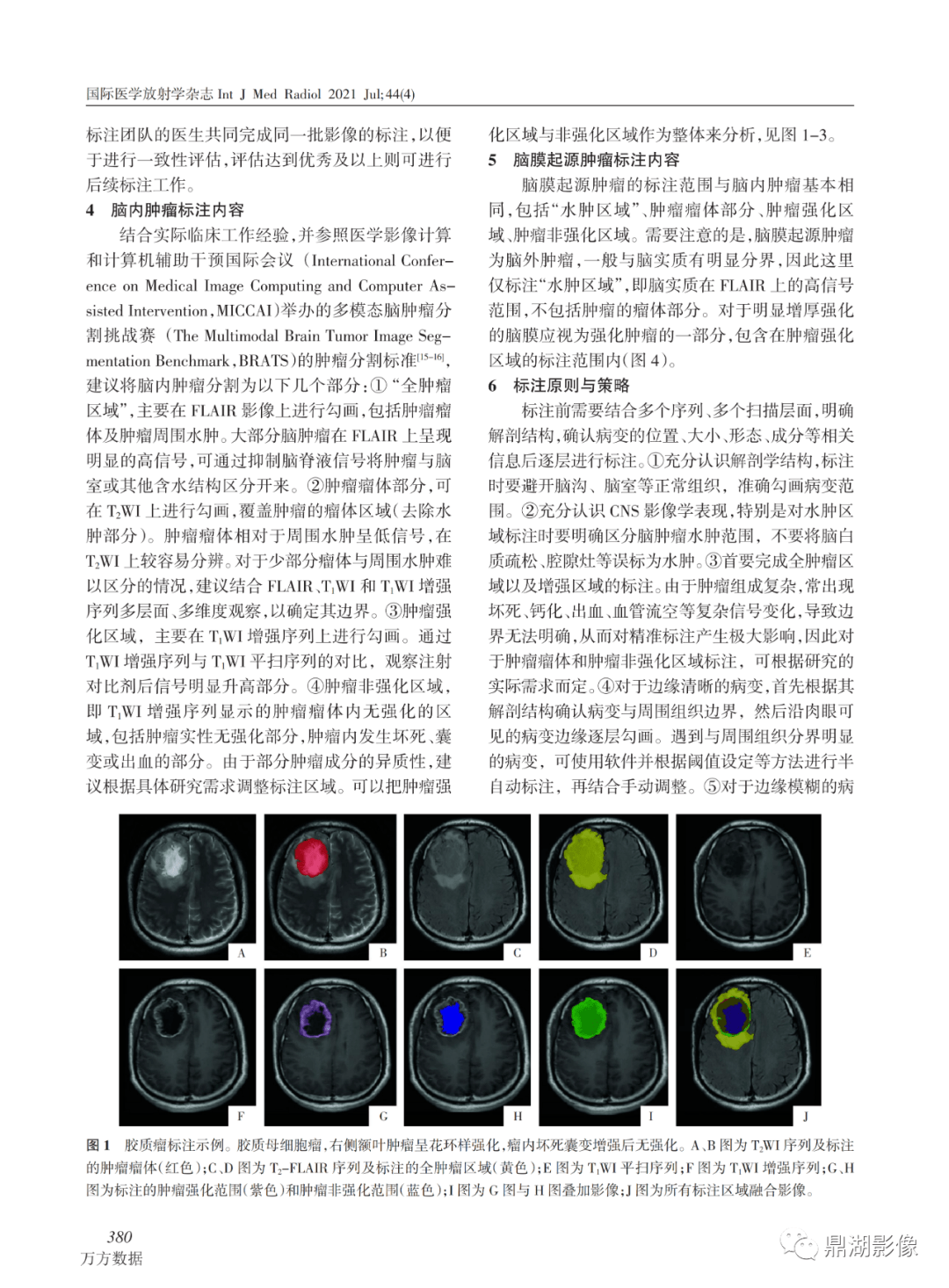 中枢神经系统肿瘤的mri影像标注专家共识_全网_解剖图_文章