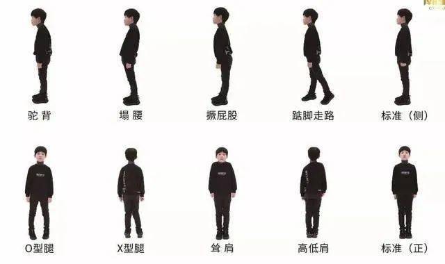 孩子体态不良知多少