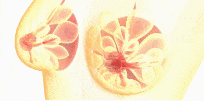 乳房|还在“糟蹋”乳房吗？试试这样穿，胸型饱满有气质