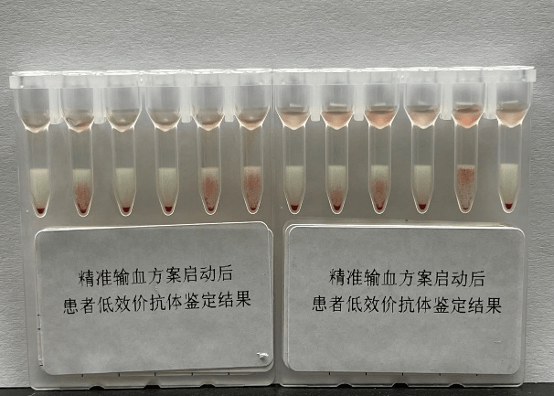 血液|【新闻快递】输血科深入开展患者血液管理见成效