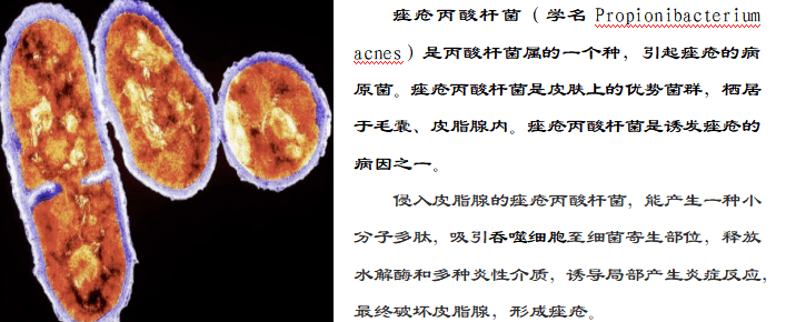 管理|【伤口管理小组】重度融合性痤疮毁颜值，中西医结合治疗最关键