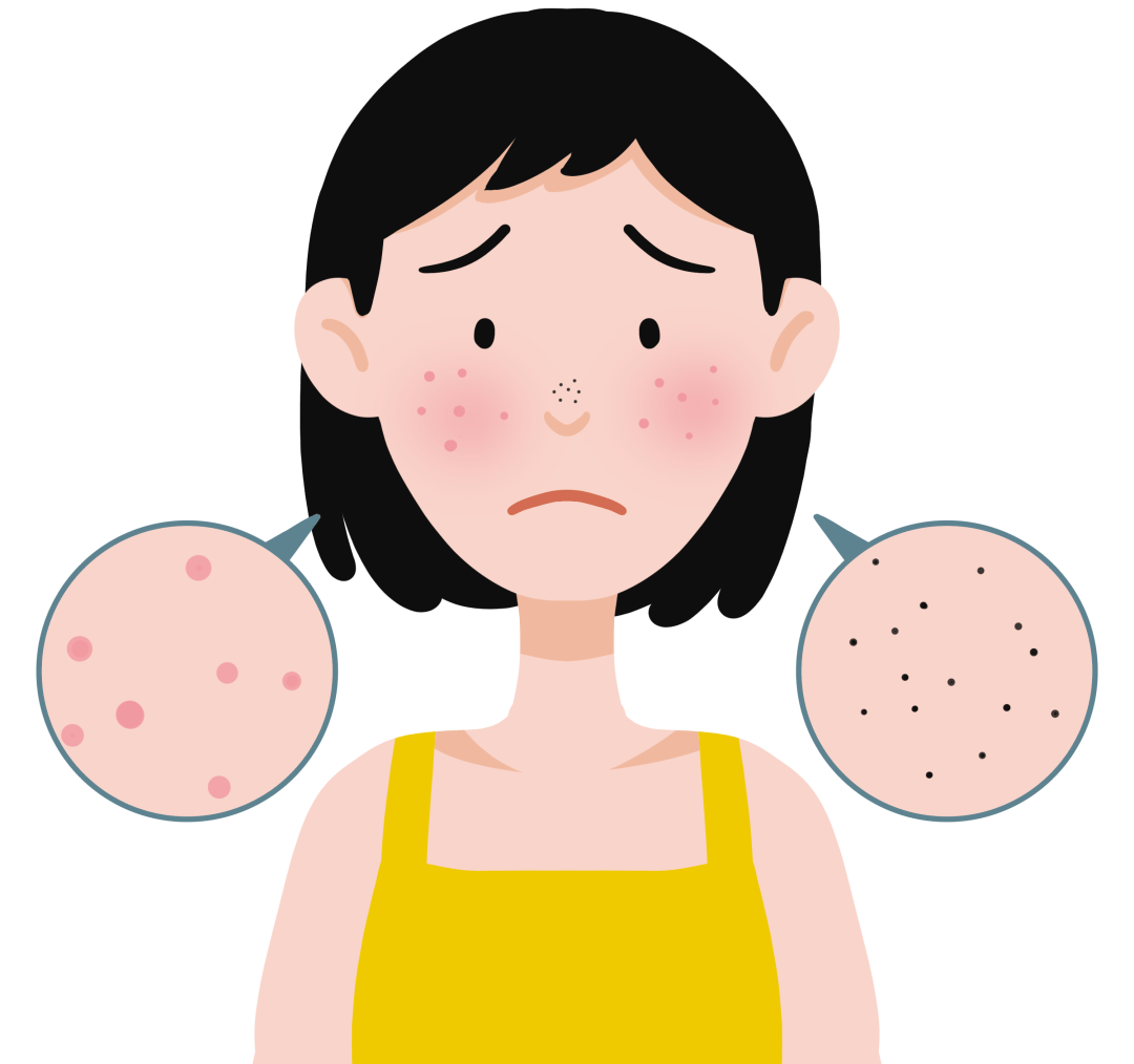 导致皮肤暗沉,发黄,眼周血液循环不良,血液淤积形成黑眼圈,肾上腺素的