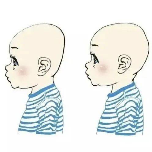 【健康】扁头VS圆头哪个更胜一筹?_宝宝_颅骨_郑州