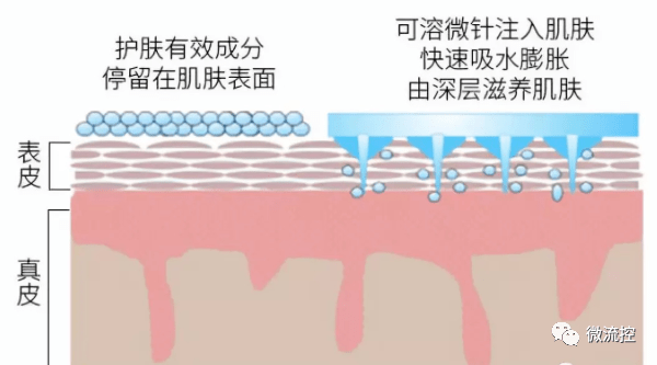 什么是生长激素针 ea98a19894b04ade9ed1d5fa1e4a191b.png