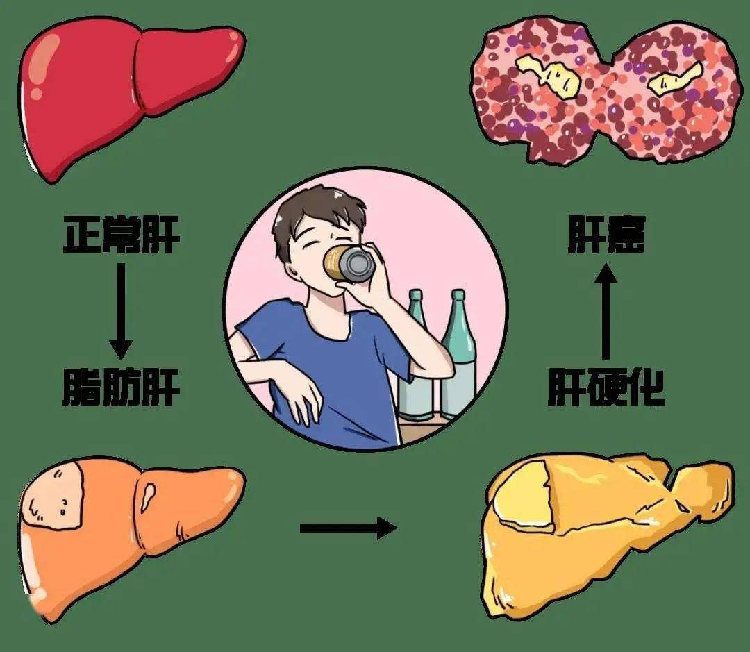 瘦下来脂肪肝会没有吗 b1f87df185344955956d3ec484f7b377.jpeg