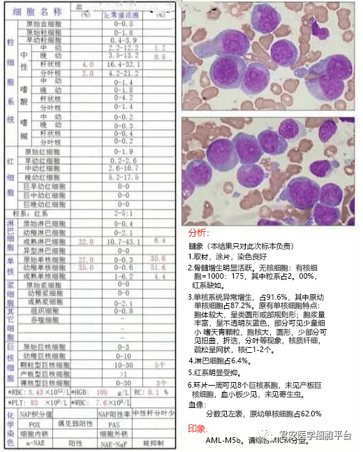 骨髓涂片报告图片