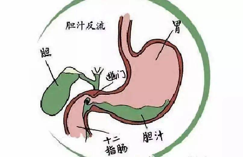 胃和十二指肠的位置图图片