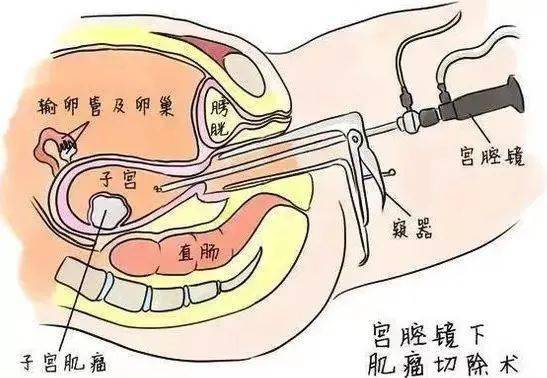 检查_阴道_治疗