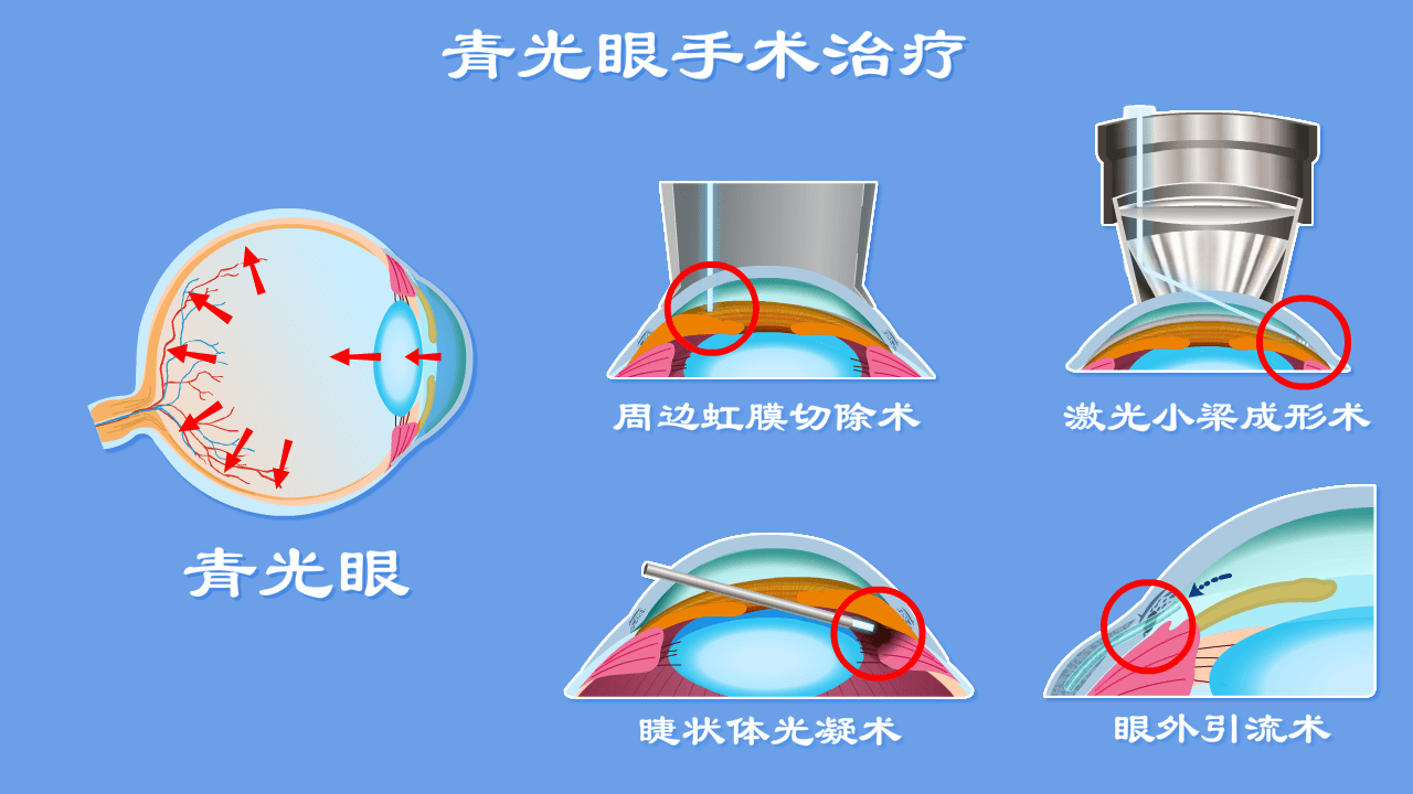 03f299710737437a84f5976b7aac8670.png