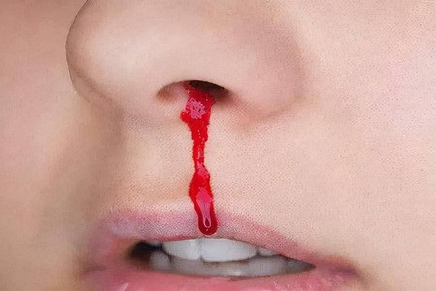 枕边殷红，是凶是吉？——解密梦见老公流鼻血的深层预兆与心灵密码