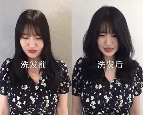 尸体头上抠下来的白泥竟是螨虫尸体!头痒头屑出油多,用它就对了