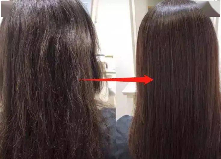 尸体头上抠下来的白泥竟是螨虫尸体!头痒头屑出油多,用它就对了