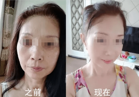 吃什么东西补充脸上的胶原蛋白 63add1ee4ddd4b82ac4faa5660809403.png