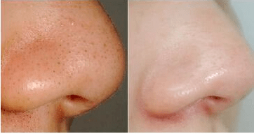 蜂巢不用洗面奶也可以把脸洗干净!用它也能搞定脸上的脏东西