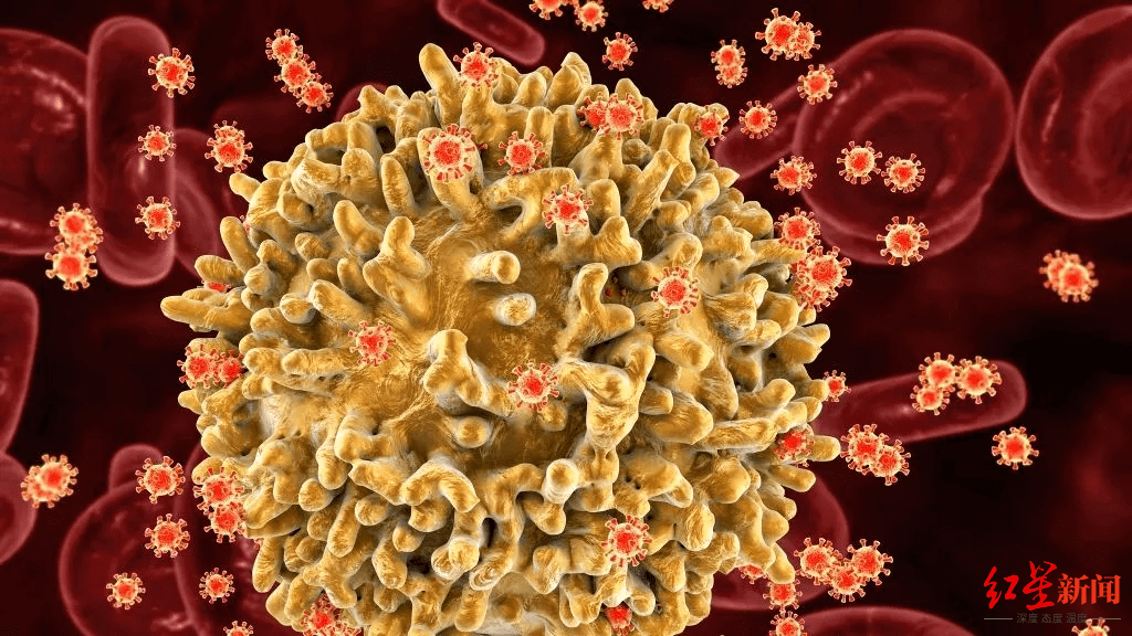 传播|高毒性高破坏性艾滋病毒变体出现！大部分感染者在荷兰，目前疗法仍有效