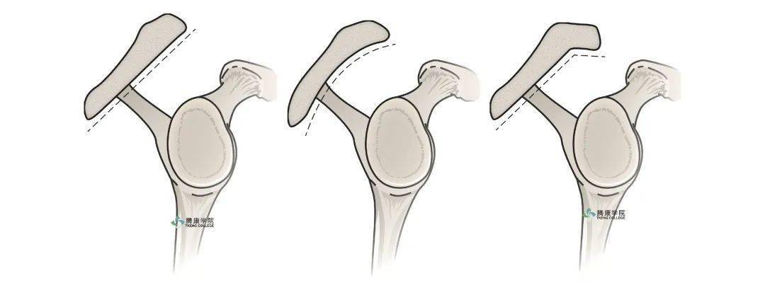 很多人都不知道,第二肩关节是什么?_活动度_during_空间