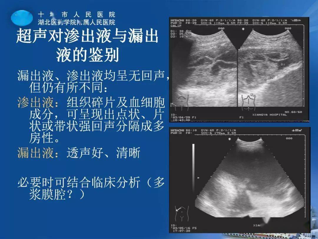 胸膜疾病影像表現