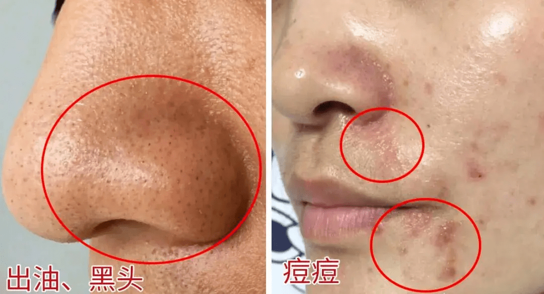 品牌立省近500！抢雪花秀“零差评”水乳6件套，补水滋润，提亮肤色