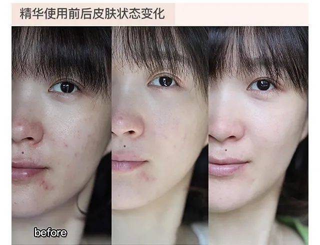 品牌专柜正品 | 雅诗兰黛骨折价限量抢，送眼霜、精华小样，买一送3