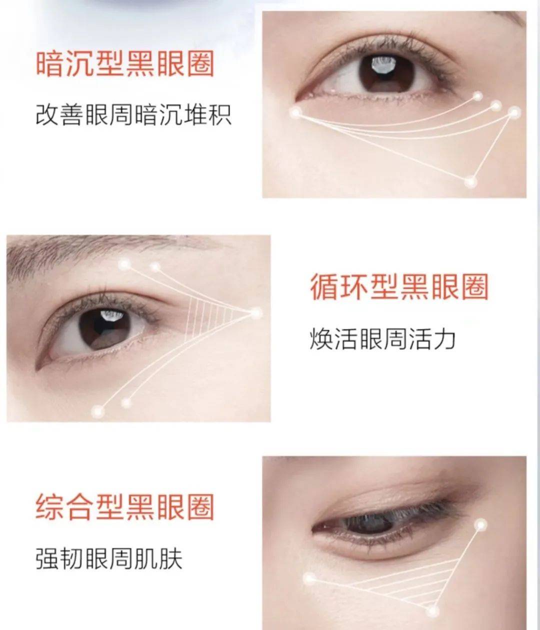 莱雅大侦探7回归，蓉拉美的小鹿眼好动人