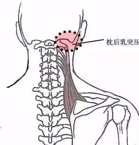 颈窝在哪里图片