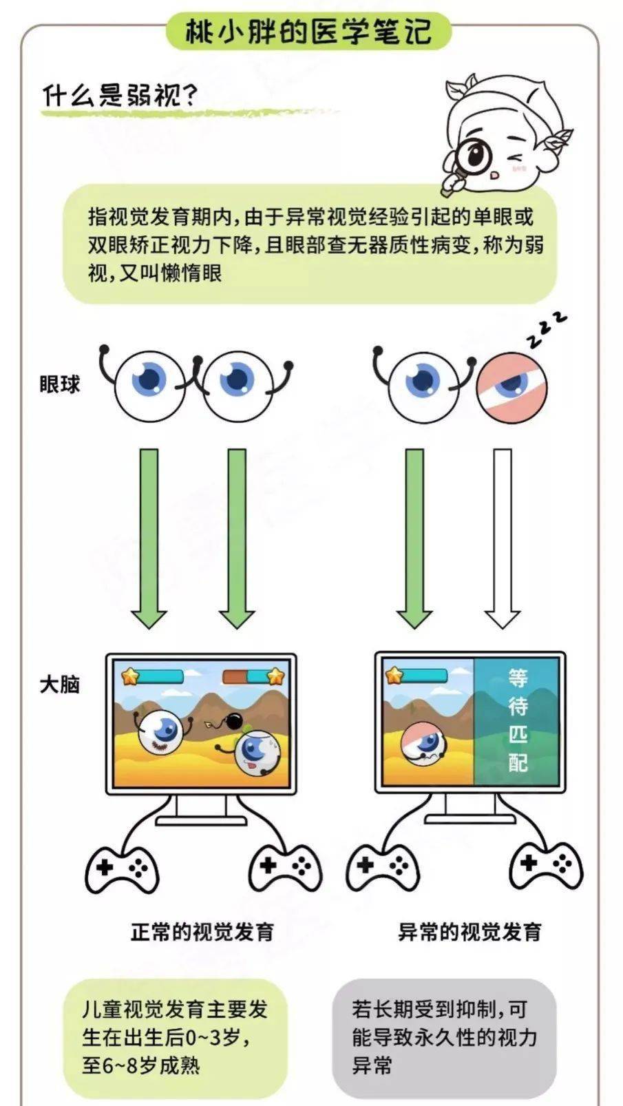 斜視弱視