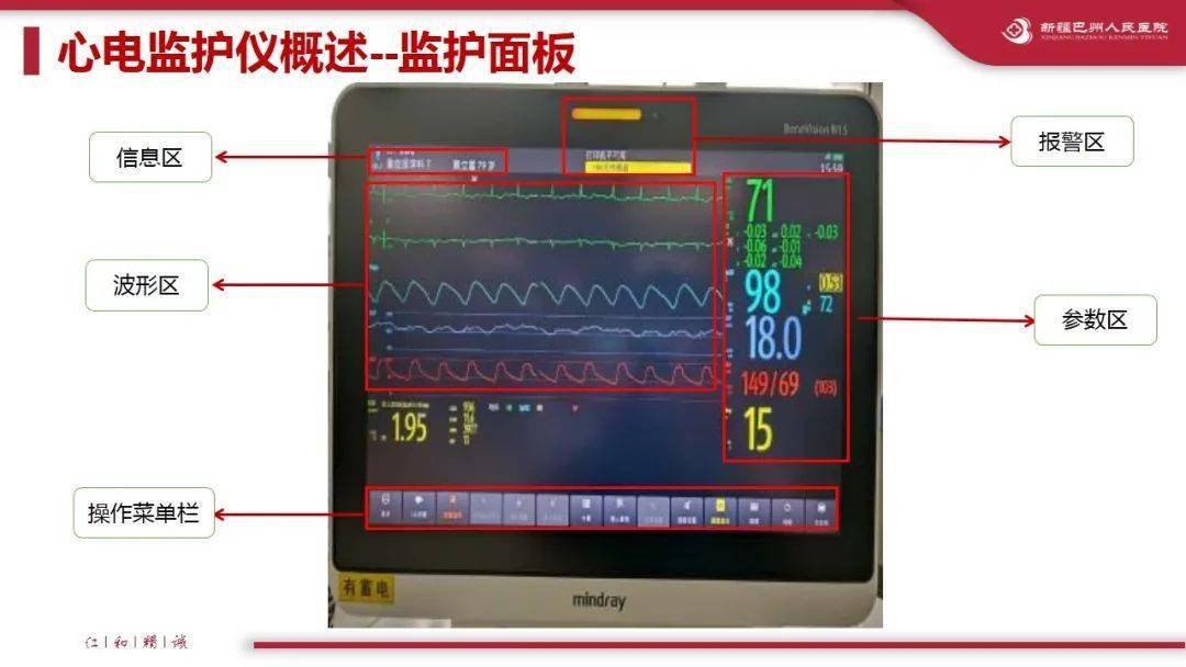 ppt運用循證護理修訂心電監護儀參數設置規範