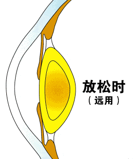 当睫状肌持续收缩形成调节的痉挛状态时,就会出现疲劳症状,又叫