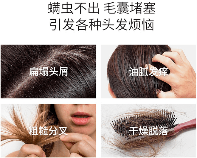 因为散着头发睡觉更健康？99%的女生都做错了，难怪头发油腻还脱发！