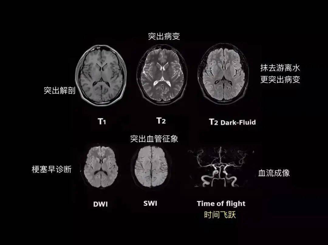 科普视窗丨x线ctmri核磁共振之间的区别