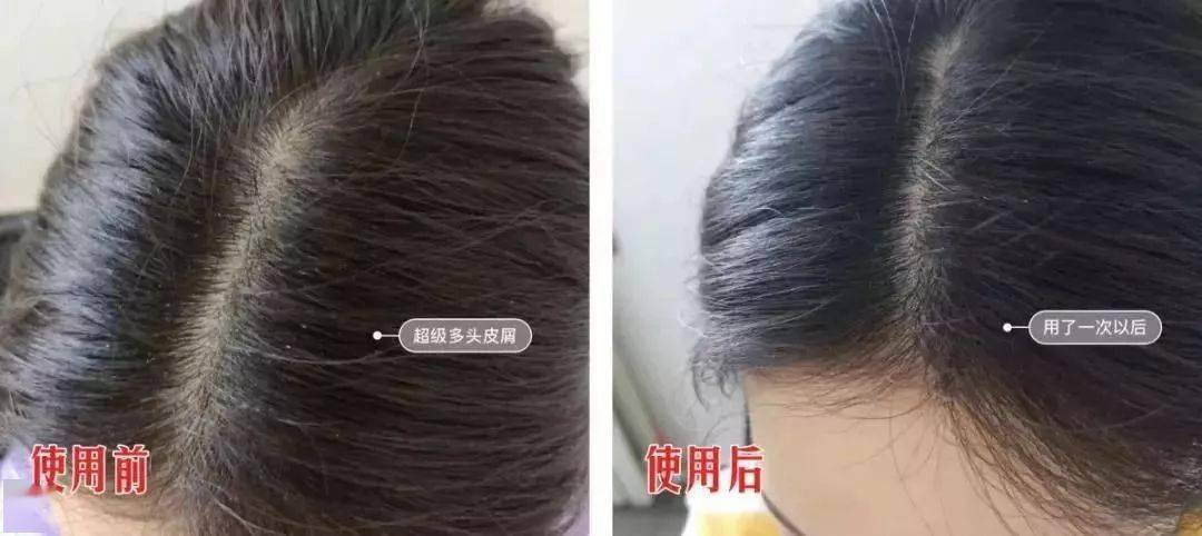 因为散着头发睡觉更健康？99%的女生都做错了，难怪头发油腻还脱发！