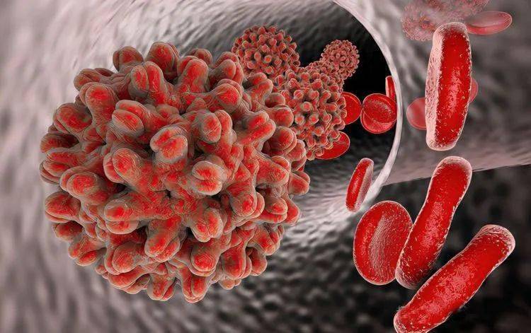 男子随地小便以为精神分裂直到狂吐去急诊后死亡被误诊了