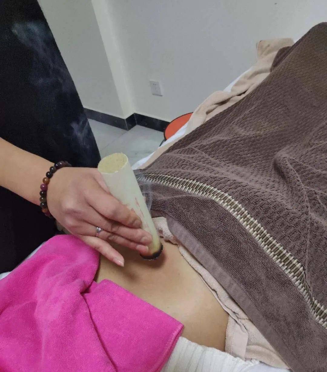 急性支气管肺炎,定时咳嗽艾灸方法_成年_全止_三焦