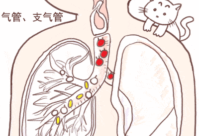 尤其是异物堵在气道入口及主气管,这