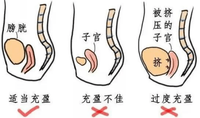 仁安61科普做彩超为什么有时候憋尿有时候空腹
