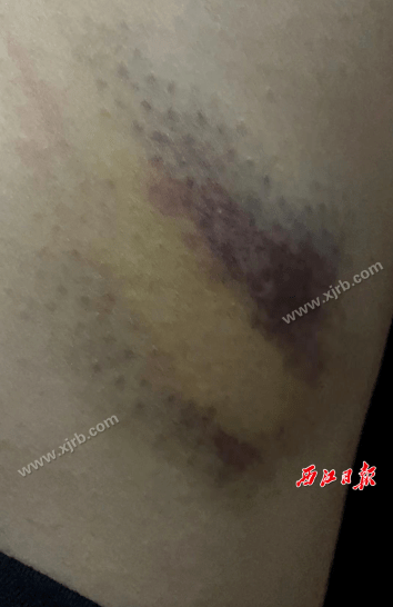 好惨！离云浮不远女子被骗到缅北遭毒打、关铁笼…“差点命都没了！”bandao游戏(图3)