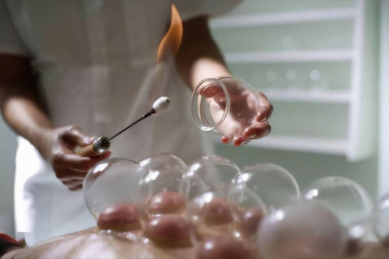 在拔火罐时又分为4种手法:闪罐,走罐,留罐,以及刺络拔罐.