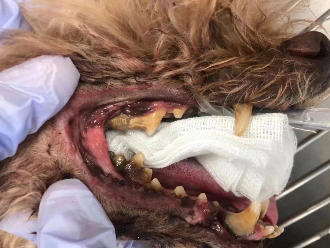 小小牙结石后果竟然那么严重