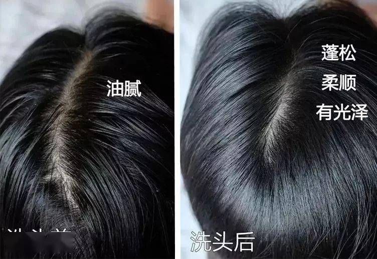 头皮头屑暴增？头皮扣下“白泥”？用Ta,帮你揪出头屑“内鬼”！清爽柔顺，发量翻一番！