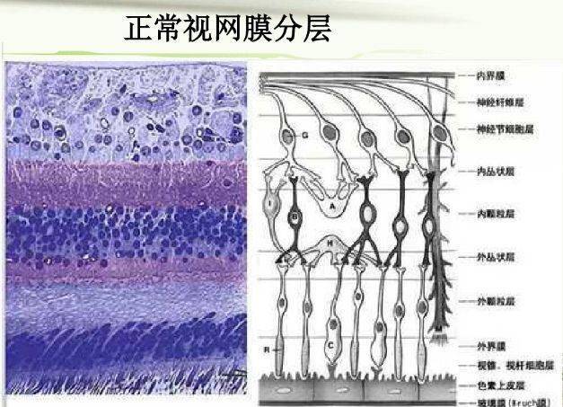 视网膜十层结构图片