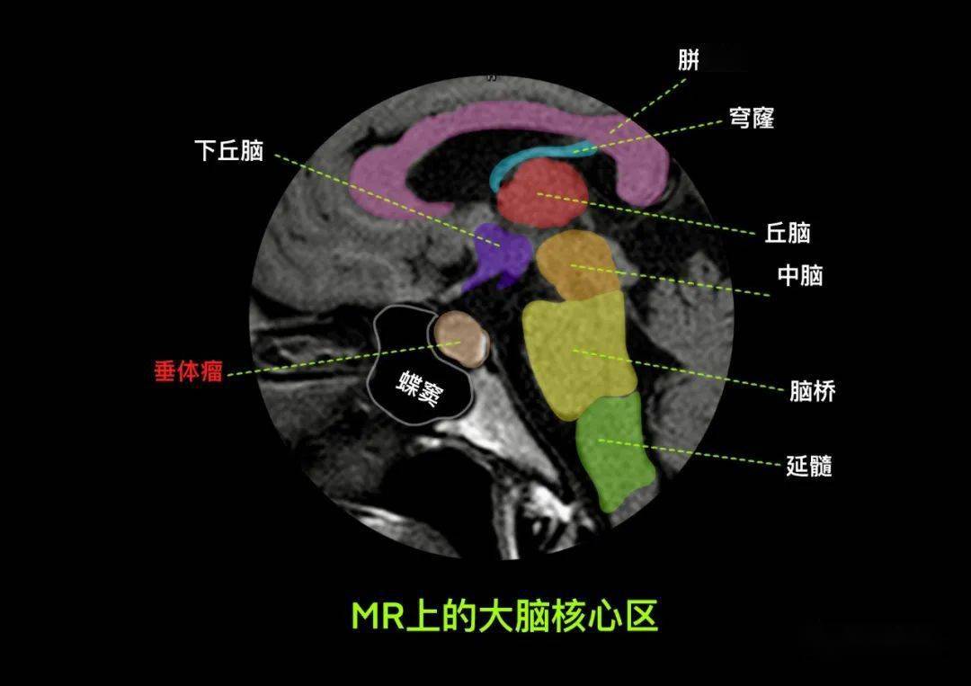 但是我們卻往往忽視了對一些解剖結構細微變化的關注