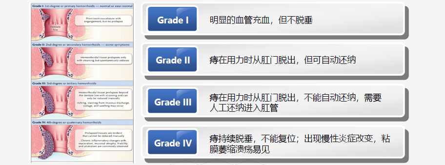 根据出血和痔组织脱出的情况,可以用内痔分度来判断病情的严重程度.