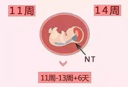 孕13周女宝生殖图图片