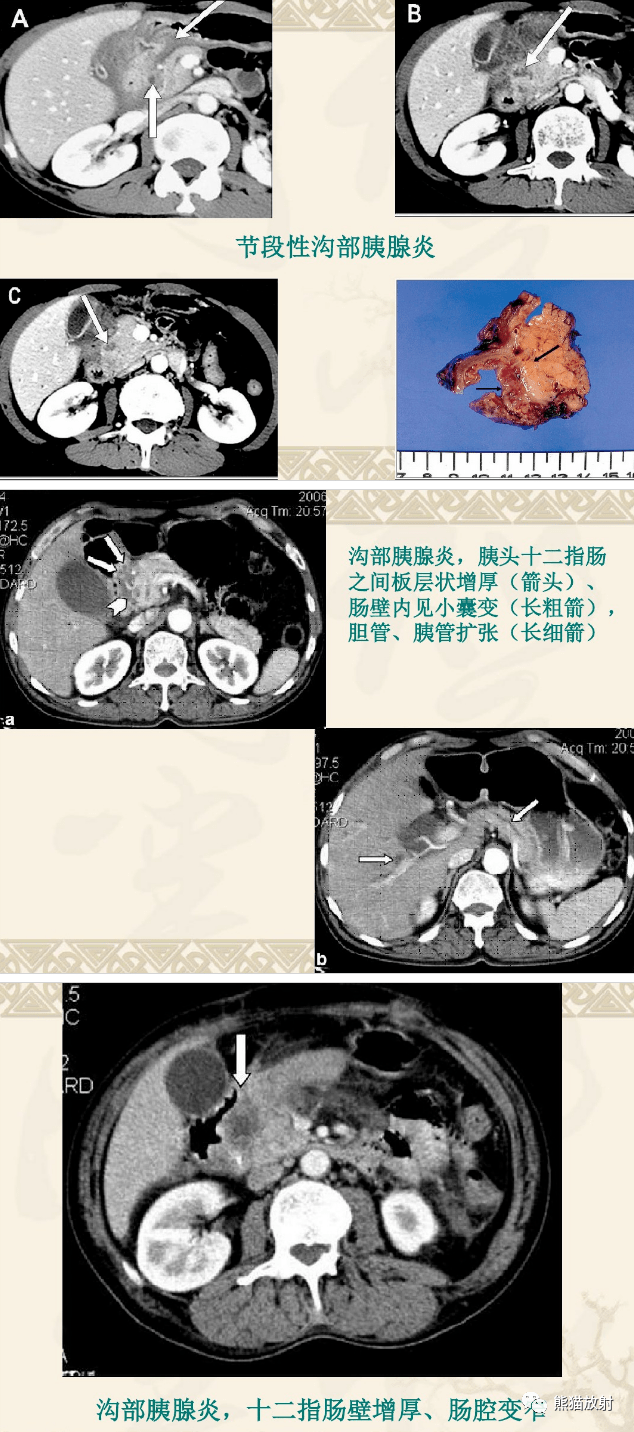 实质|临床及影像表现