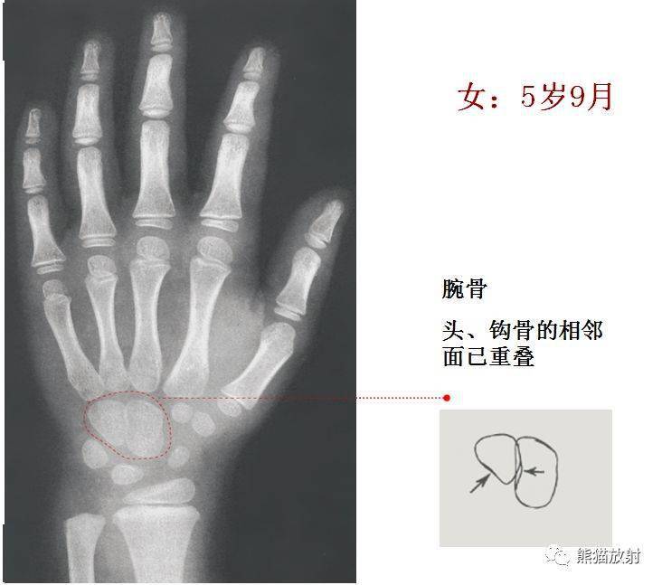 骨像应图的意思图片