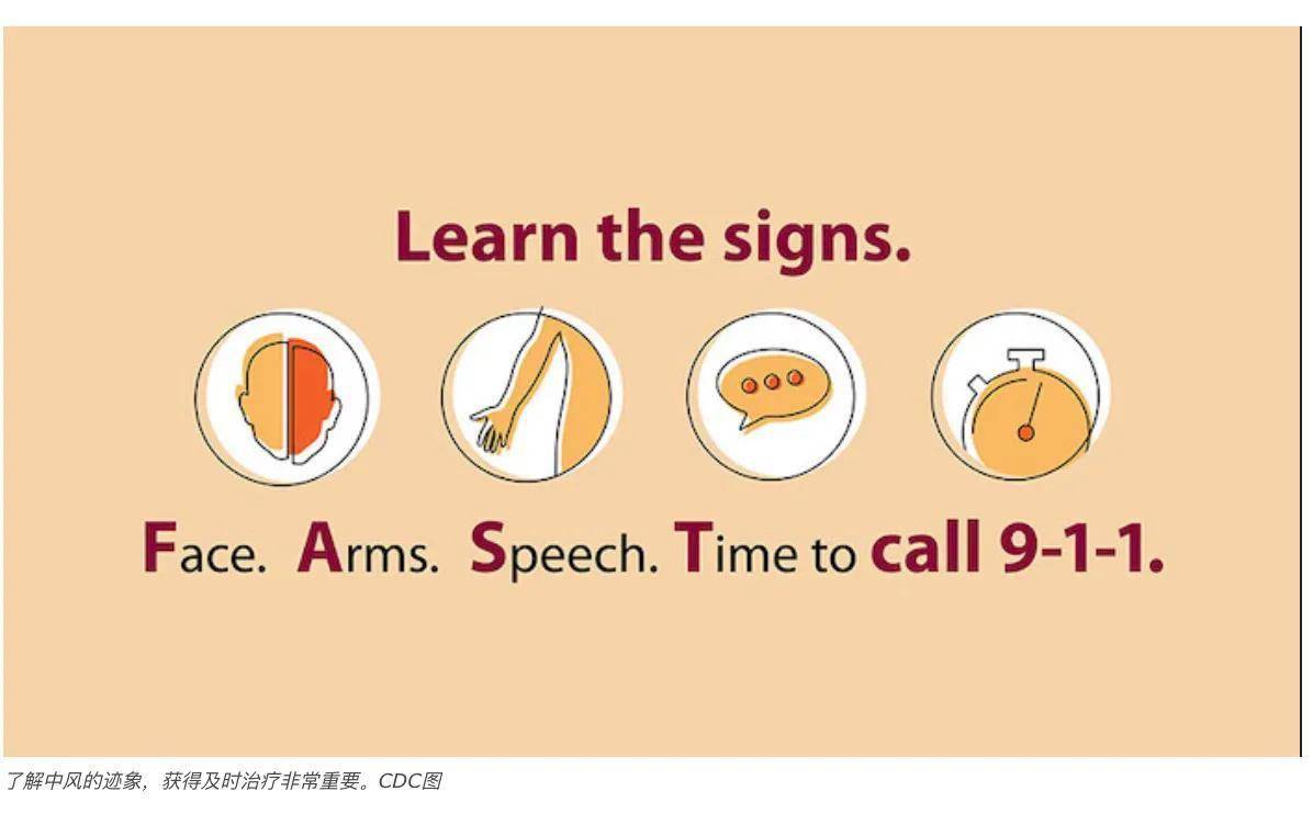 cdc圖克利夫蘭醫學中心信息指出,瞭解中風的跡象並獲得及時治療非常