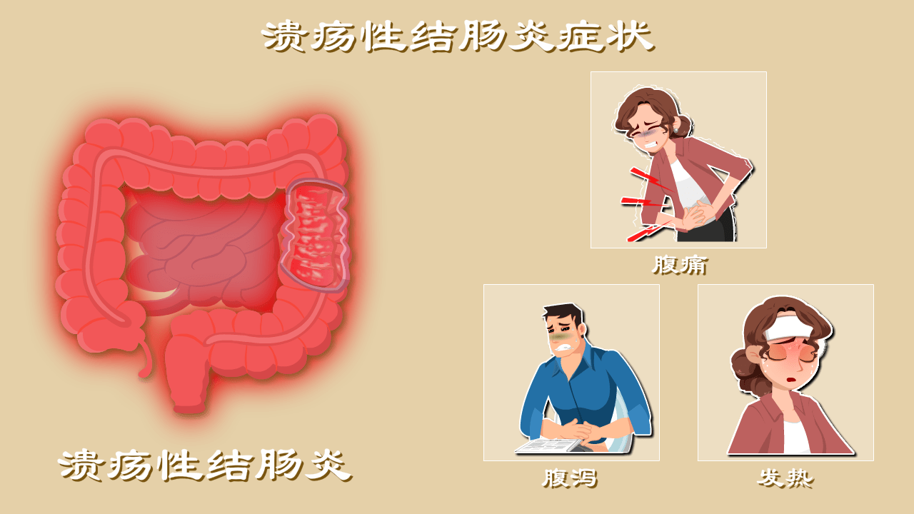 结肠炎什么症状 来自搜狐网
